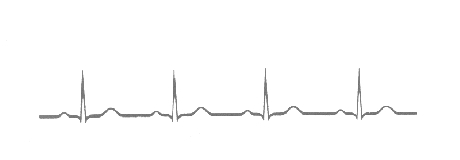 (ekg)